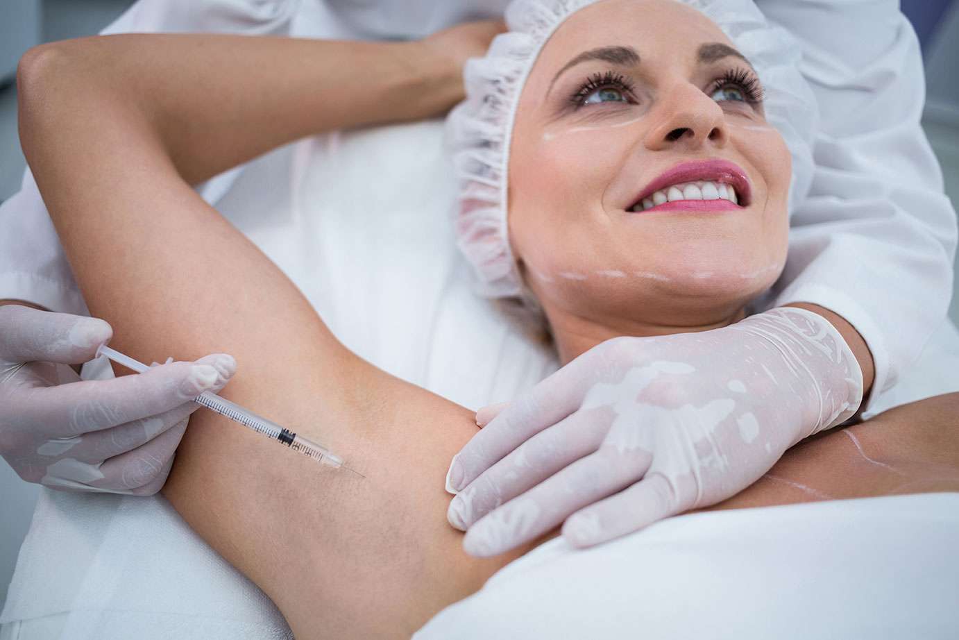 botox for arm pits sweating botox for arm pits sweating